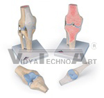 Sectional Knee Joint model, 3 part